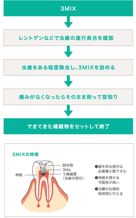 3MIXの虫歯治療手順をご説明します。まず虫歯の進行具合を確認し、虫歯をある程度除去し、3MIXを詰めます。痛みがなくなったら、そのまま削って型取りを行い、作成した補綴物を取り付けます。